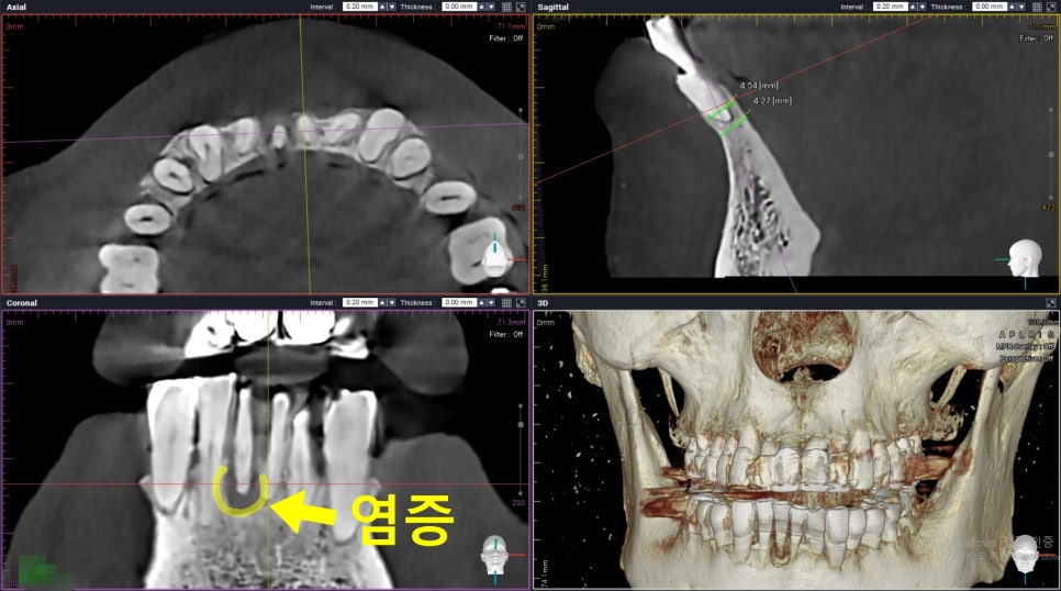 소래포구역치과추천 메타치과의원 상담 공간